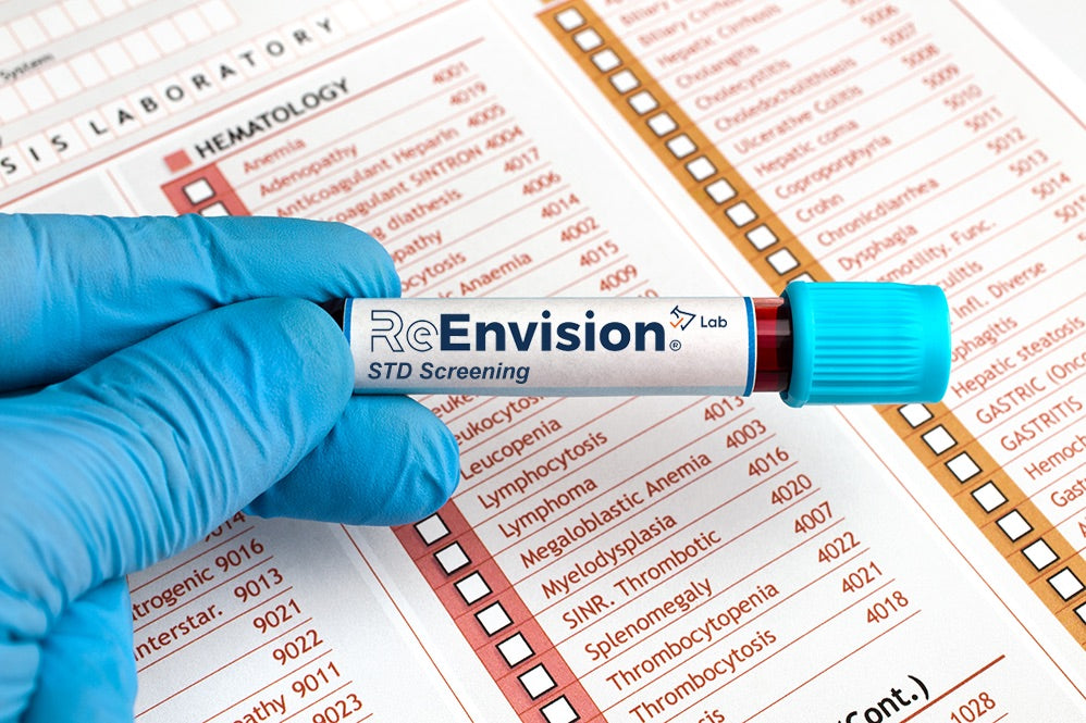 STD Screening Test (Comprehensive)