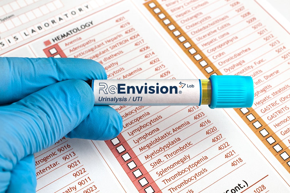 Urinalysis / Urinary Tract Infection (UTI) Test